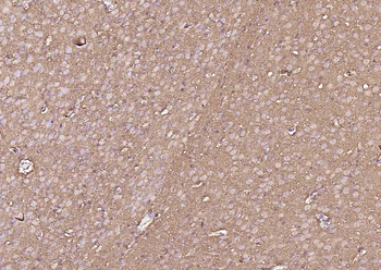 Tubulin beta-III Recombinant Rabbit Monoclonal Antibody