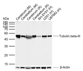 Tubulin beta-III Recombinant Rabbit Monoclonal Antibody