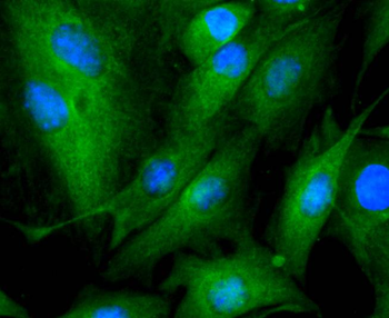 Tubulin beta-III Recombinant Rabbit Monoclonal Antibody