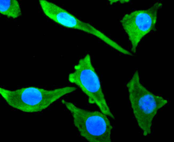 Tubulin beta-III Recombinant Rabbit Monoclonal Antibody
