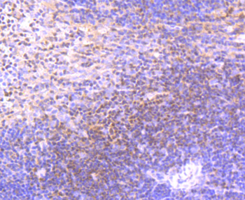 ETS1 Recombinant Rabbit Monoclonal Antibody