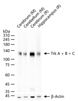 Trk A + B + C Recombinant Rabbit Monoclonal Antibody