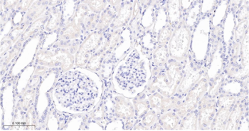 Trk A + B + C Recombinant Rabbit Monoclonal Antibody