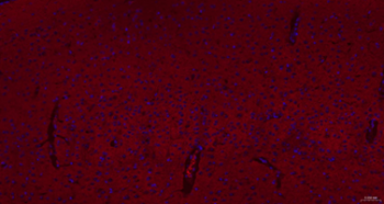 Trk A + B + C Recombinant Rabbit Monoclonal Antibody