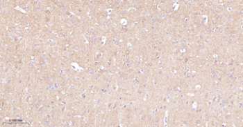 Trk A + B + C Recombinant Rabbit Monoclonal Antibody