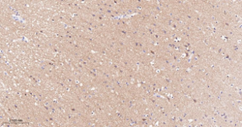 Trk A + B + C Recombinant Rabbit Monoclonal Antibody