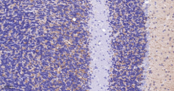 Trk A + B + C Recombinant Rabbit Monoclonal Antibody