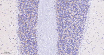 Trk A + B + C Recombinant Rabbit Monoclonal Antibody