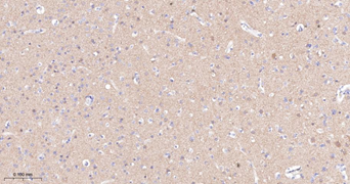 Trk A + B + C Recombinant Rabbit Monoclonal Antibody