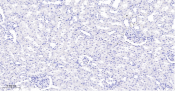 Trk A + B + C Recombinant Rabbit Monoclonal Antibody