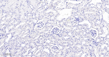 Trk A + B + C Recombinant Rabbit Monoclonal Antibody