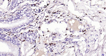 CD4 Recombinant Rabbit Monoclonal Antibody