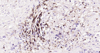 CD4 Recombinant Rabbit Monoclonal Antibody