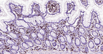 CD4 Recombinant Rabbit Monoclonal Antibody