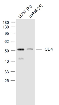 CD4 Recombinant Rabbit Monoclonal Antibody