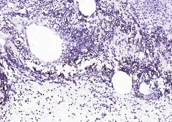 CD4 Recombinant Rabbit Monoclonal Antibody
