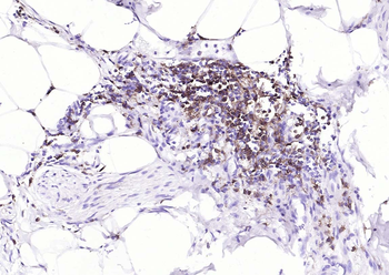 CD4 Recombinant Rabbit Monoclonal Antibody