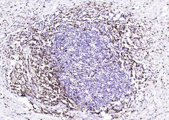 CD4 Recombinant Rabbit Monoclonal Antibody