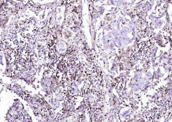 CD4 Recombinant Rabbit Monoclonal Antibody