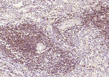 CD4 Recombinant Rabbit Monoclonal Antibody