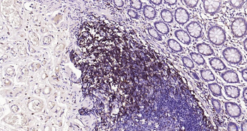 CD4 Recombinant Rabbit Monoclonal Antibody