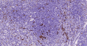 MERTK Recombinant Rabbit Monoclonal Antibody