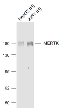 MERTK Recombinant Rabbit Monoclonal Antibody