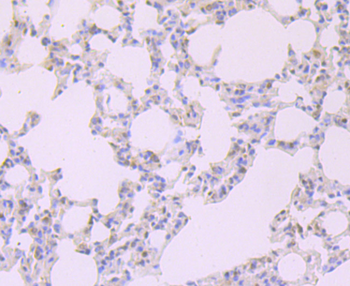 FKBP51 Recombinant Rabbit Monoclonal Antibody
