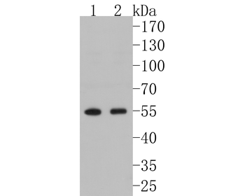 FKBP51 Recombinant Rabbit Monoclonal Antibody