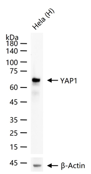 YAP1 Recombinant Rabbit Monoclonal Antibody