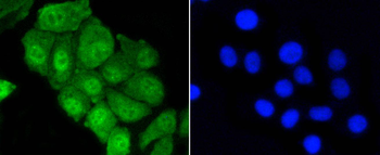 YAP1 Recombinant Rabbit Monoclonal Antibody
