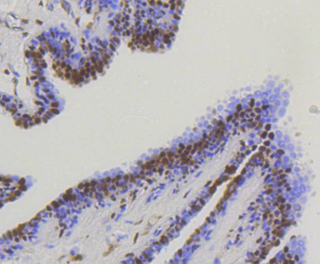 YAP1 Recombinant Rabbit Monoclonal Antibody