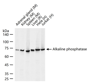 Alkaline phosphatase, tissue-nonspecific isozyme Recombinant Rabbit Monoclonal Antibody