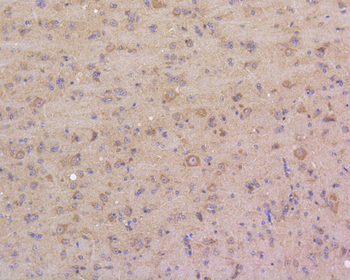 DUSP6 Recombinant Rabbit Monoclonal Antibody