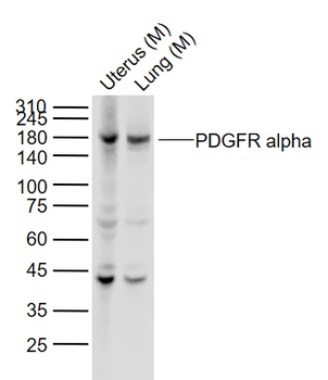 PDGFR alpha Recombinant Rabbit Monoclonal Antibody