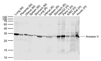 Annexin V Recombinant Rabbit Monoclonal Antibody