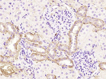 ZNT8 Rabbit Polyclonal Antibody