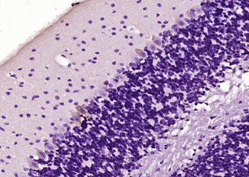 CRMP5 Rabbit Polyclonal Antibody