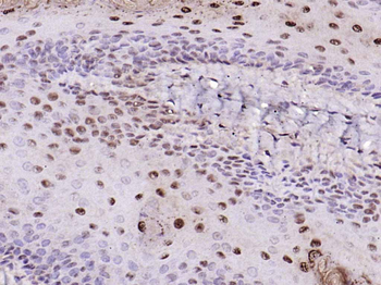 Nur77 Rabbit Polyclonal Antibody