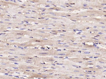 TNMD Rabbit Polyclonal Antibody