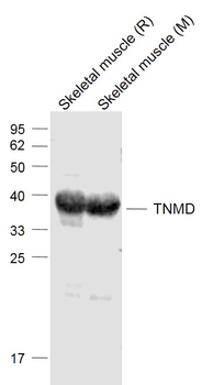 TNMD Rabbit Polyclonal Antibody