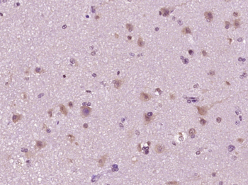 Phospho-HDAC6 (Ser22) Rabbit Polyclonal Antibody