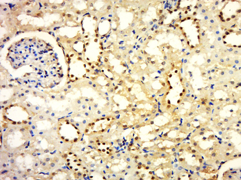 Phospho-HER2 (Tyr877) Rabbit Polyclonal Antibody