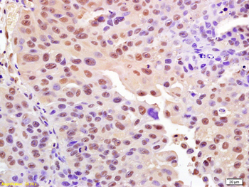 Phospho-H2AX (Ser139) Rabbit Polyclonal Antibody