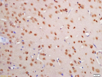 Histone H3 (tri methyl K36) Rabbit Polyclonal Antibody
