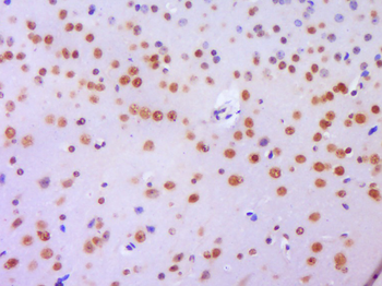 Histone H3 (Di Methyl K36) Rabbit Polyclonal Antibody