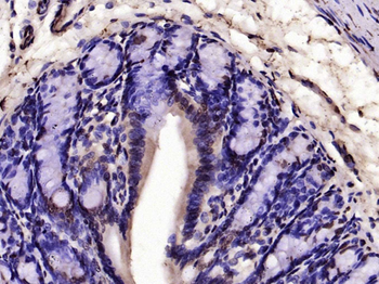 Histone H3 (Di Methyl K36) Rabbit Polyclonal Antibody