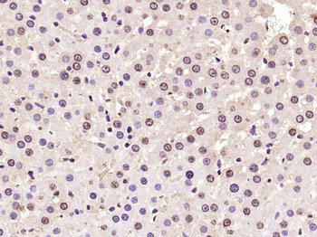 Histone H3 (Di Methyl K36) Rabbit Polyclonal Antibody