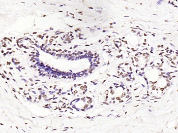 Histone H3 (Di Methyl K9) Rabbit Polyclonal Antibody