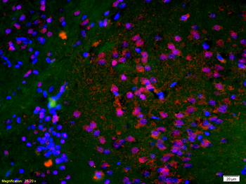 Histone H3 (Di Methyl K9) Rabbit Polyclonal Antibody